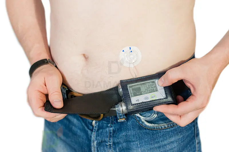 Чехол кожаный М-1 для помпы Медтроник